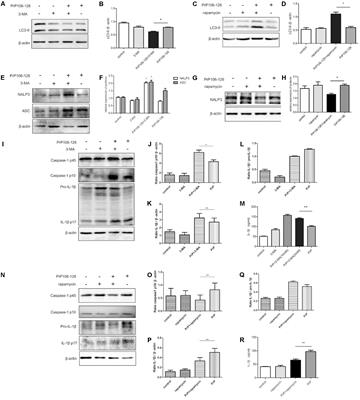 Frontiers The NLRP3 Caspase 1 Inflammasome Negatively Regulates